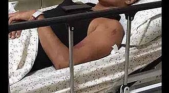 Jake Cuenca hurt in bike accident
